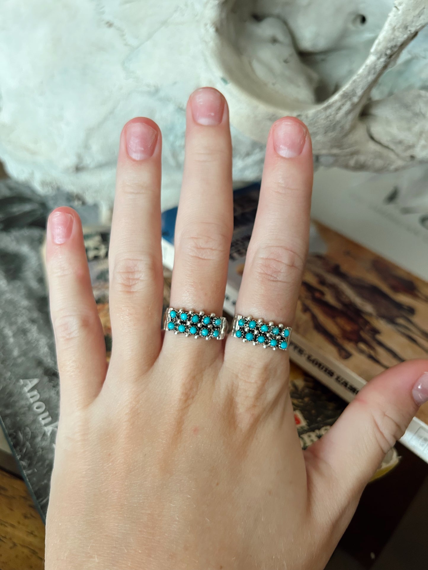 The Landry Ring